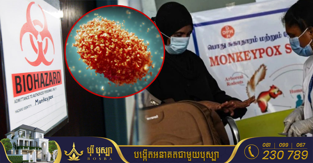 ប្រទេសឥណ្ឌា បានបញ្ជាក់ពីករណីដំបូងបង្អស់នៃជំងឺអុតស្វា monkeypox