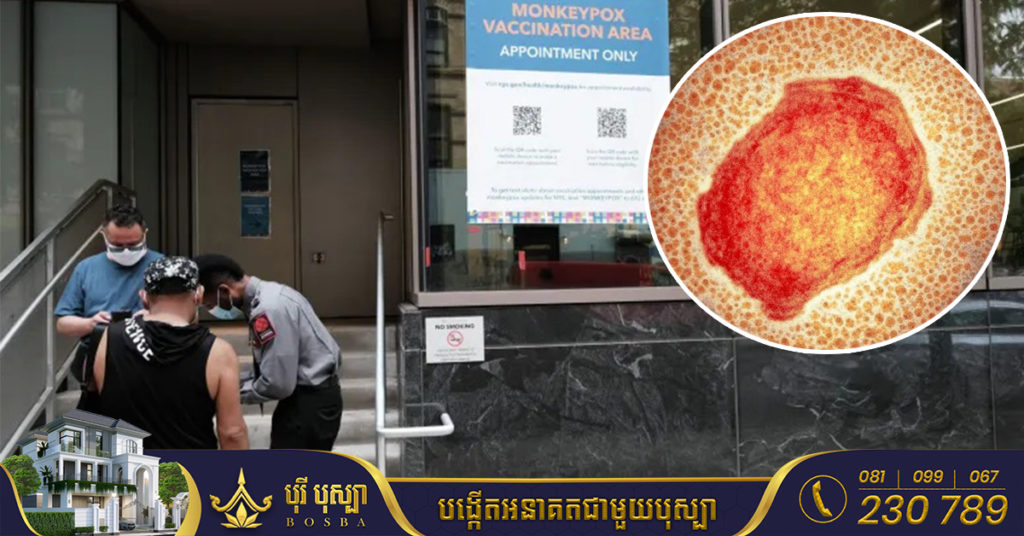 ចំនួន​ករណី​ជំងឺ​អុត​ស្វា Monkeypox ​ដែល​បាន​បញ្ជាក់​នៅសហរដ្ឋអាមេរិកបាន​កើន​ដល់​ ១០,០០០ ករណី