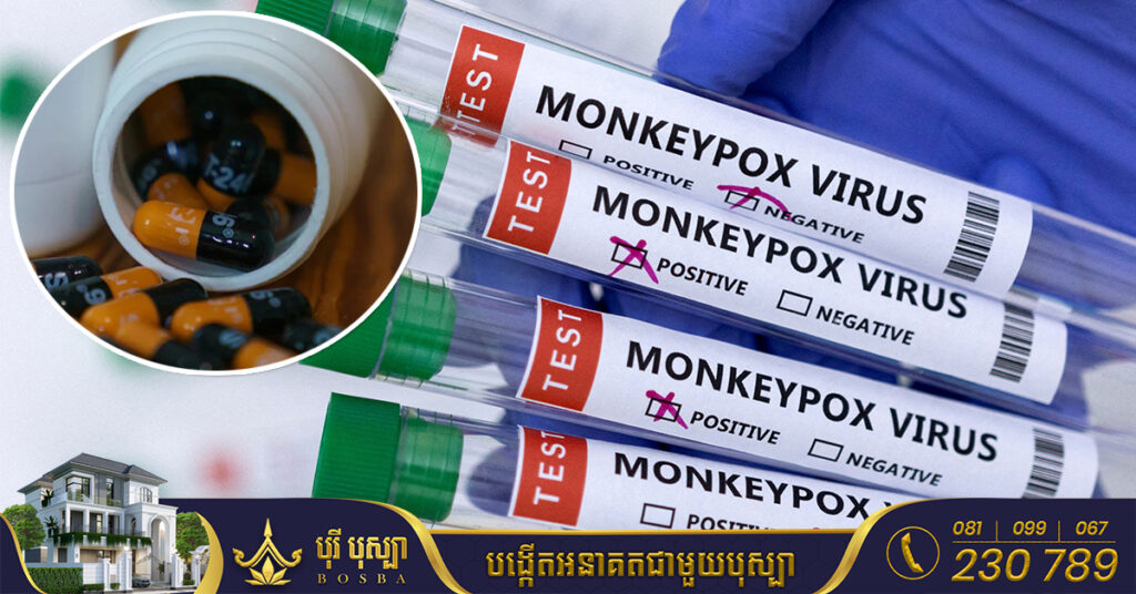 អ្នកជំនាញអាមេរិកព្រមានថា ជំងឺអ៊ុតស្វា Monkeypox អាចបំប្លែងខ្លួនដើម្បីទប់ទល់ជាមួយនឹងថ្នាំបាន