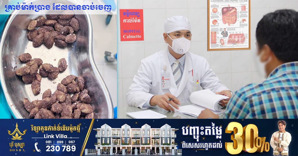 កុំប្រហែស! អ៊ំប្រុសម្នាក់ បរិភោគផ្លែម៉ាក់ប្រាងទាំងគ្រាប់អស់ជាច្រើនថ្ងៃ បណ្ដាលឱ្យឈឺចុកឆ្អល់នៅចុងដង្ហើម ក៏សម្រេចមកមន្ទីរពេទ្យកាល់ម៉ែត ត្រូវបានគ្រូពេទ្យសង្គ្រោះចាប់យកគ្រាប់នោះចេញម្តងមួយៗ ដោយជោគជ័យ
