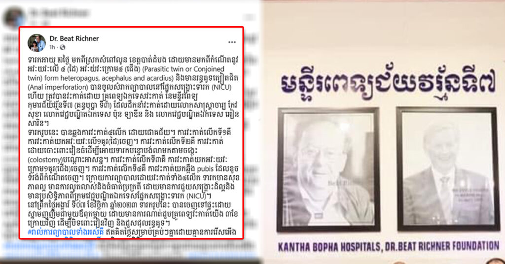 អស្ចារ្យណាស់! គ្រូពេទ្យគន្ធបុប្ផា ជួយវះ-កាត់ទារកកើតមានអវៈយវៈមិនប្រក្រតី (ដៃ៤ ជើង៤) រហូតជោគជ័យ