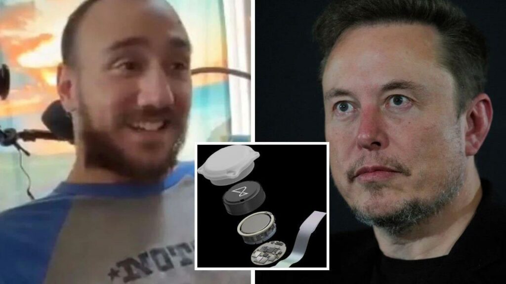 កាន់តែអស្ចារ្យ! គម្រោងផ្សាំបន្ទះឈីបក្នុងខួរក្បាលមនុស្សរបស់ Elon Musk អាចធ្វើឱ្យមនុស្សពិការម្នាក់ លេងអុកអនឡាញបានជាលើកដំបូង