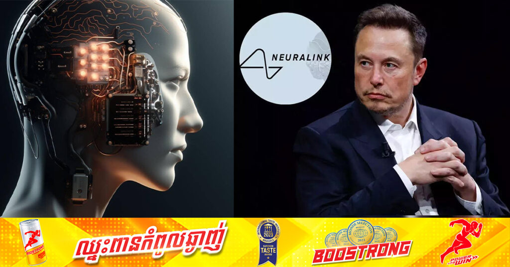 Elon Musk ប្រាប់ថាគម្រោងផ្សាំបន្ទះឈីបចូលទៅក្នុងខួរក្បាលអ្នកជំងឺជាលើកទីពីរ ទទួលបានជោគជ័យ