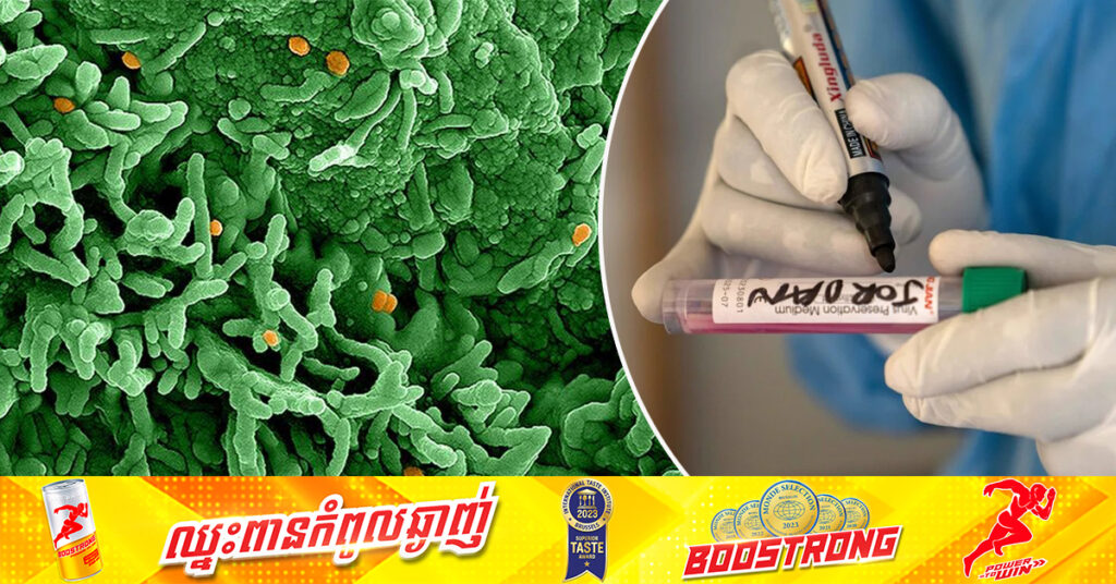 មន្ត្រី WHO ថាជំងឺ mpox ឬអុតស្វា មិនមែនជាកូវីដ១៩ថ្មី នោះទេ