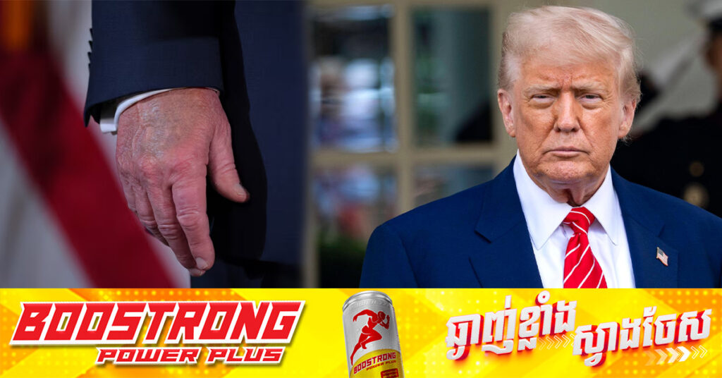 សេតវិមានបញ្ជាក់ថា លោក ត្រាំ មានជំងឺសសៃឈាមវ៉ែនបណ្ដាលឱ្យហើមជើង និងជាំដៃ