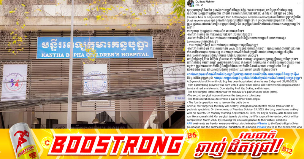 ពន្លឺជីវិតថ្មី! កុមារាម្នាក់ដែលកើតមានដៃ៤ ជើង៤ ឆ្លងកាត់ការវះ-កាត់ ៤ដំណាក់កាលដោយជោគជ័យ នៅមន្ទីរពេទ្យគន្ធបុប្ផា, បច្ចុប្បន្នភាពសុខភាពល្អធម្មតាដូចកុមារទូទៅ