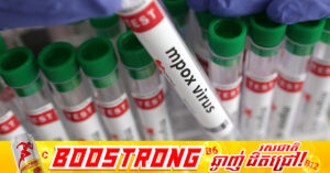 ថៃកំពុងតាមដានករណីឆ្លងជំងឺ Mpox ជាថ្មីម្តងទៀត ក្រោយរកឃើញអ្នកតេស្តវិជ្ជមាន ២ករណី